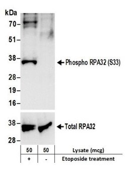RPA2, p Ser33 Antibody, Novus Biologicals 100 &mu;L | Buy Online | Novus Biologicals | Fisher Scientific